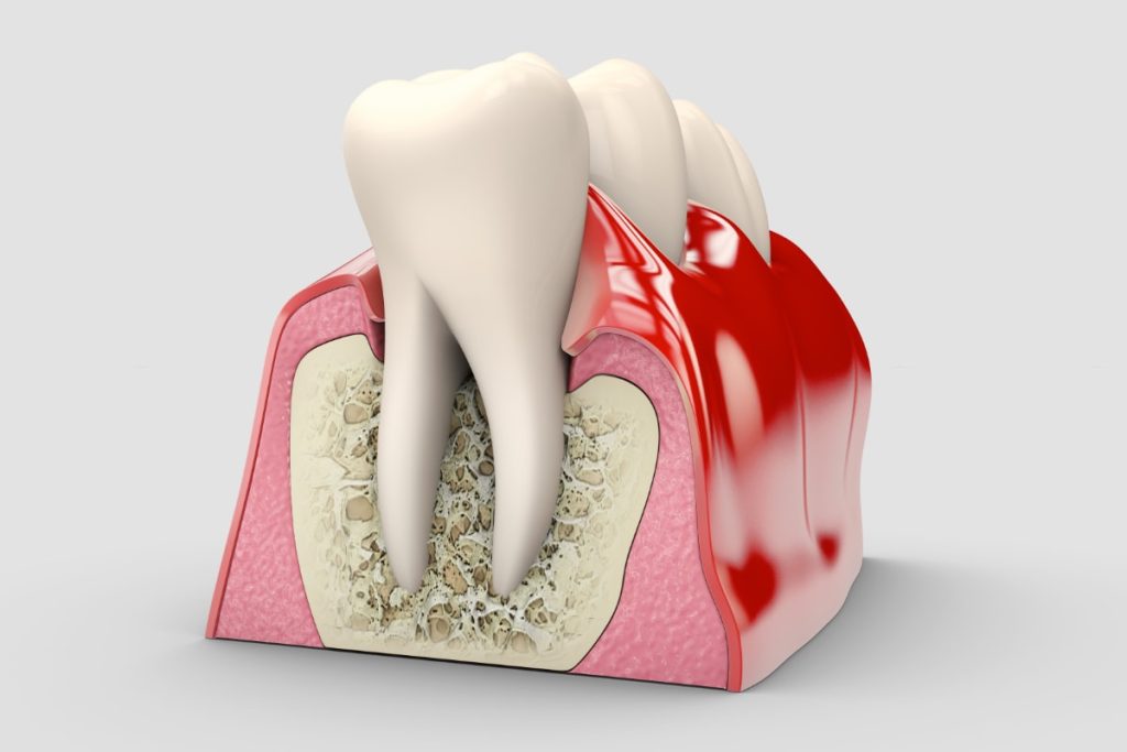 Periodontia Smilemoreportugal